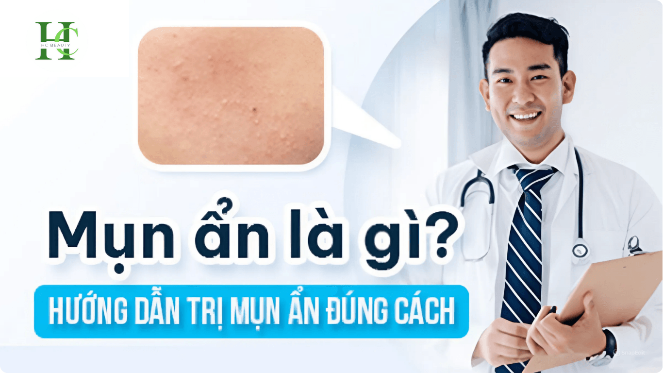 Kem trị mụn ẩn tốt nhất